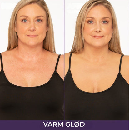 Naturlig Foundation